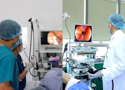 Vì sao cần phát hiện và xử lý polyp đại tràng?