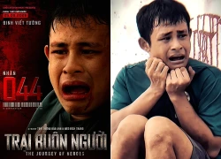 Nể phục diễn viên Vbiz mắc chứng thần kinh hiếm gặp: Vượt nghịch cảnh để làm nghề, hát hay - diễn giỏi xứng điểm 100!