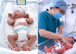 Bé trai sinh non mắc bệnh vảy cá hiếm gặp