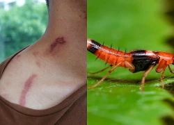 Kiến ba khoang vào mùa 'tấn công' sinh viên, tràn vào chung cư TP.HCM